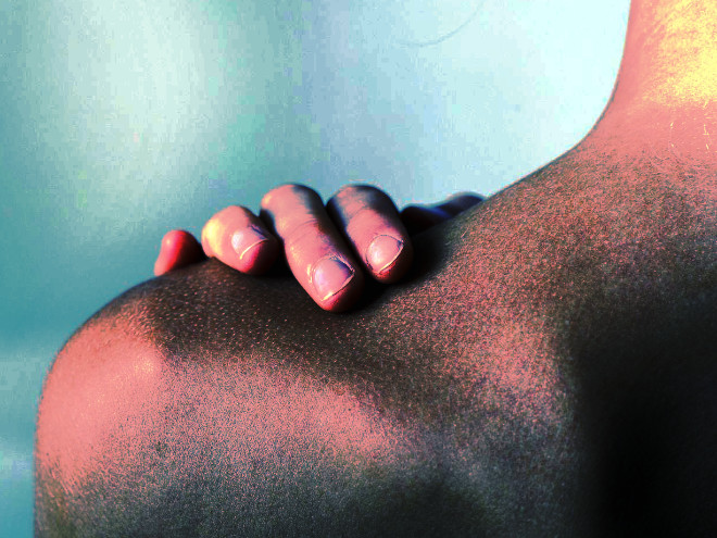 Кожный туберкулез